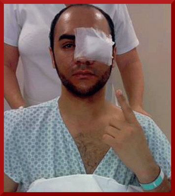  sergiosilvafotografofutursherido-bala-goma-17june-arqpessoaldiv