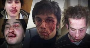 epistoli_h_300_182-300x160