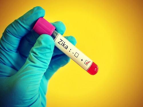 zika-virus